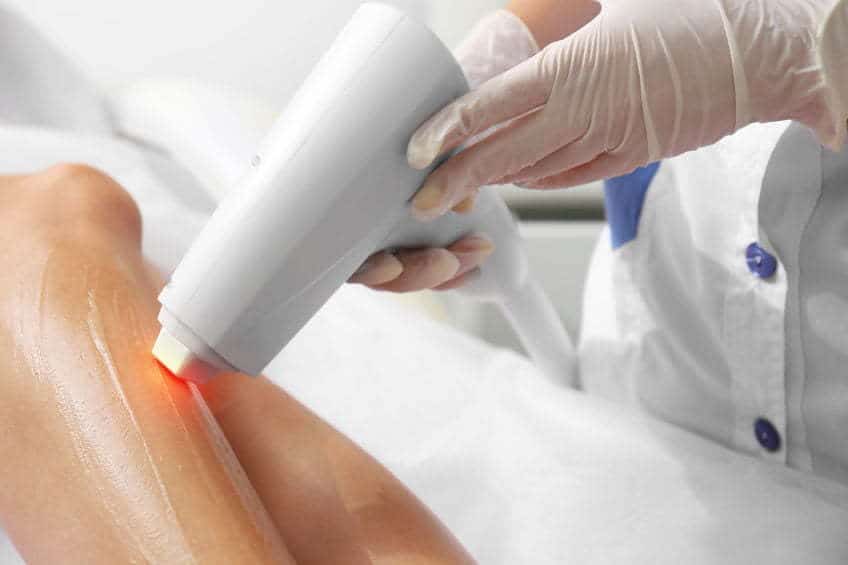 laser hair removal procedure
