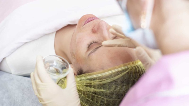 A professional cosmetologist applies a chemical peeling solution to the patient on the skin of the face with the help of hands in gloves. Close-up.