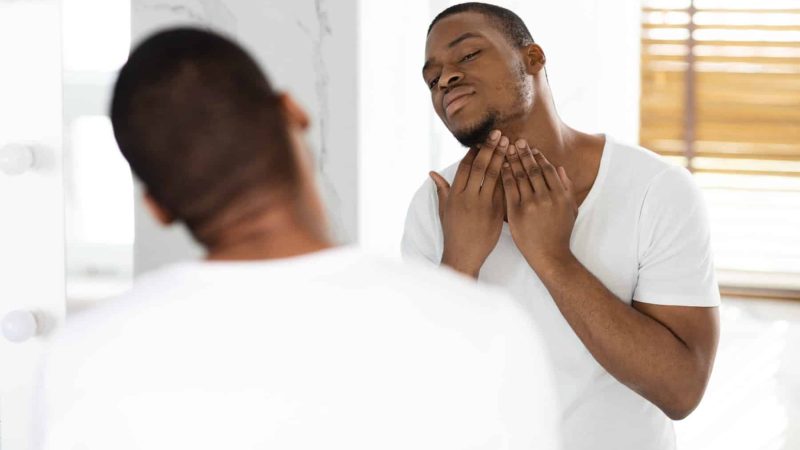 Ingrown Hair Problem. Portrait Of Unshaved Black Guy Touching Neck With Bristle While Standing Near Mirror In Bathroom, Unhappy African American Man Making Morning Beauty Routine At Home